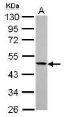 Anti-YARS2 antibody used in Western Blot (WB). GTX119009