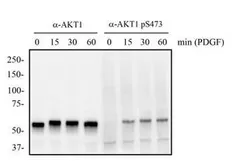 Anti-AKT (phospho Ser473) antibody [104A282] used in Western Blot (WB). GTX11901
