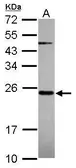 Anti-MRPS23 antibody used in Western Blot (WB). GTX119012
