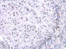 Anti-WDR74 antibody [N1C2] used in IHC (Paraffin sections) (IHC-P). GTX119013