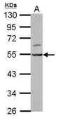Anti-LSM11 antibody used in Western Blot (WB). GTX119023