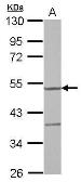 Anti-YARS2 antibody used in Western Blot (WB). GTX119029