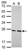 Anti-MRPS23 antibody [N1C3] used in Western Blot (WB). GTX119032