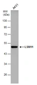 Anti-LSM11 antibody used in Western Blot (WB). GTX119039