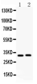 Anti-IL1 beta antibody used in Western Blot (WB). GTX11904