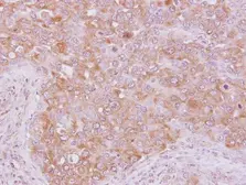 Anti-p190-B RhoGAP antibody used in IHC (Paraffin sections) (IHC-P). GTX119041