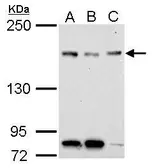 Anti-NFKBIL2 antibody [N1N2], N-term used in Western Blot (WB). GTX119058