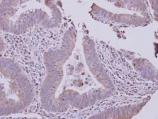 Anti-SLC22A18AS antibody used in IHC (Paraffin sections) (IHC-P). GTX119059