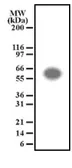 Anti-ATF2 antibody used in Western Blot (WB). GTX11908