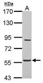 Anti-BAT5 antibody used in Western Blot (WB). GTX119080