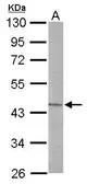 Anti-LDB2 antibody [N1C1] used in Western Blot (WB). GTX119092