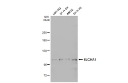Anti-SLC24A1 antibody [C1C3] used in Western Blot (WB). GTX119094