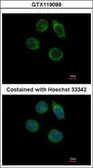 Anti-CHST2 antibody [N3C3] used in Immunocytochemistry/ Immunofluorescence (ICC/IF). GTX119099
