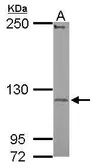 Anti-UBE3C antibody [N1N3] used in Western Blot (WB). GTX119102