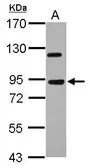 Anti-KIAA0317 antibody [N1N2], N-term used in Western Blot (WB). GTX119103