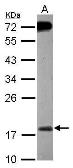 Anti-MSRB2 antibody [N1C3] used in Western Blot (WB). GTX119117