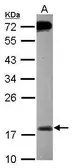 Anti-MSRB2 antibody [N1C3] used in Western Blot (WB). GTX119117