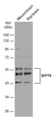 Anti-SEPT8 antibody used in Western Blot (WB). GTX119118