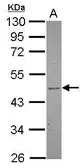 Anti-TBL2 antibody used in Western Blot (WB). GTX119131