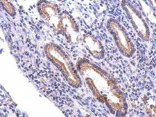 Anti-NDOR1 antibody [N2C2], Internal used in IHC (Paraffin sections) (IHC-P). GTX119139