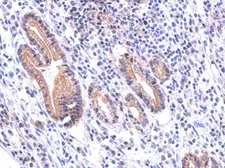Anti-DUOX1 antibody [N1N3] used in IHC (Paraffin sections) (IHC-P). GTX119160