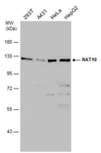 Anti-NAT10 antibody used in Western Blot (WB). GTX119167