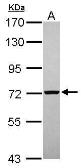Anti-PGM2 antibody [N1C2] used in Western Blot (WB). GTX119168