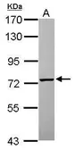 Anti-PGM2 antibody [C1C3] used in Western Blot (WB). GTX119169