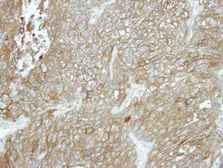 Anti-CPXM1 antibody [N3C3] used in IHC (Paraffin sections) (IHC-P). GTX119190