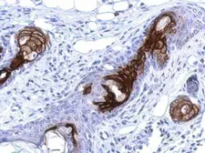 Anti-WDR19 antibody [N1N2], N-term used in IHC (Paraffin sections) (IHC-P). GTX119202