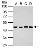 Anti-TSCOT antibody used in Western Blot (WB). GTX119204