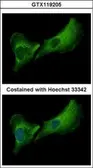 Anti-DNASE2B antibody [N1C3] used in Immunocytochemistry/ Immunofluorescence (ICC/IF). GTX119205