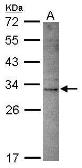 Anti-DNASE2B antibody [N2C3] used in Western Blot (WB). GTX119206