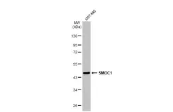 Anti-SMOC1 antibody [N2C3] used in Western Blot (WB). GTX119208
