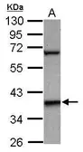 Anti-LHX5 antibody [N2C2], Internal used in Western Blot (WB). GTX119209