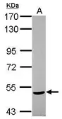 Anti-NPEPL1 antibody [N2C1], Internal used in Western Blot (WB). GTX119217