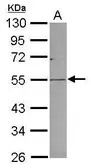 Anti-PLVAP antibody [N3C3] used in Western Blot (WB). GTX119233