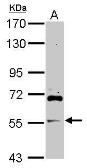 Anti-ARFGAP2 antibody used in Western Blot (WB). GTX119238