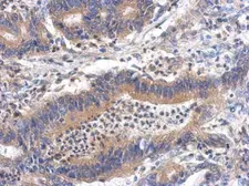 Anti-GHDC antibody [N1C2] used in IHC (Paraffin sections) (IHC-P). GTX119239
