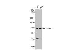 Anti-ZNF598 antibody [N1N3] used in Western Blot (WB). GTX119245