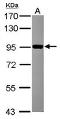 Anti-ZNF598 antibody [N1N3] used in Western Blot (WB). GTX119245