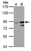 Anti-ZNF598 antibody used in Western Blot (WB). GTX119246