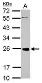 Anti-PRKCDBP antibody used in Western Blot (WB). GTX119250
