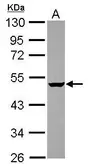 Anti-GABPB2 antibody used in Western Blot (WB). GTX119261