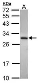 Anti-ADHFE1 antibody [N1C1] used in Western Blot (WB). GTX119264