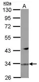 Anti-FBXO16 antibody used in Western Blot (WB). GTX119274