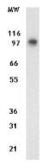 Anti-DAP5 antibody [39C534.1] used in Western Blot (WB). GTX11929