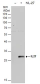 Anti-IL27 antibody [N1C3-2] used in Western Blot (WB). GTX119293