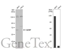 Anti-GERP antibody used in Western Blot (WB). GTX119312