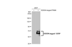 Anti-GERP antibody used in Western Blot (WB). GTX119312